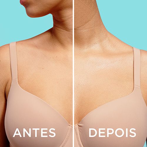 imagen aloe bsf 3