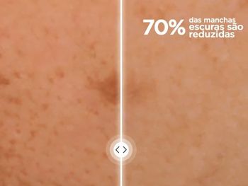 gar content bloc b a 2025 banner 600x450 PT