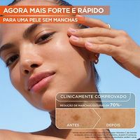 Serum Vitamina C