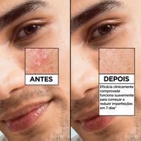 Garnier Pure Active Salicylic Sérum Antiimperfeições