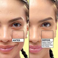 WonderTint Vitamina C Medio