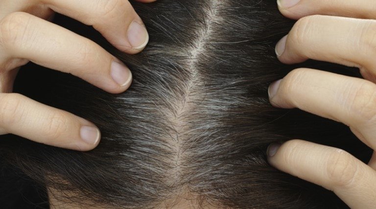 preocupada com as raízes do cabelo? tudo o que precisas saber para as esconder